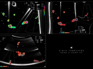echo scan distortion effect by banging joints 1