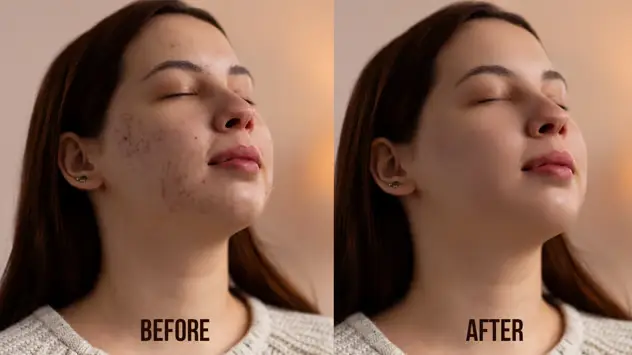 Magic Face Retouching 4 magic face retouching3
